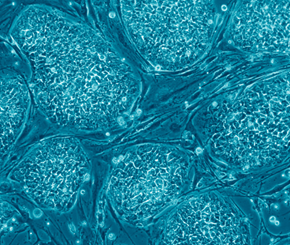 自体干细胞健康改善